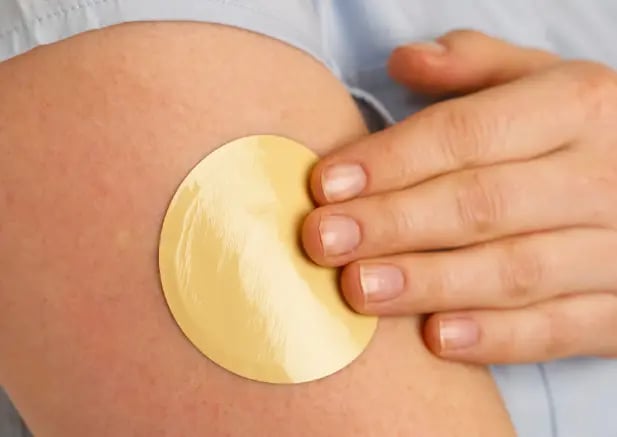 Medical adhesive applied to an arm