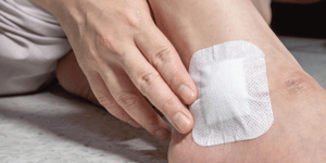 island wound dressing