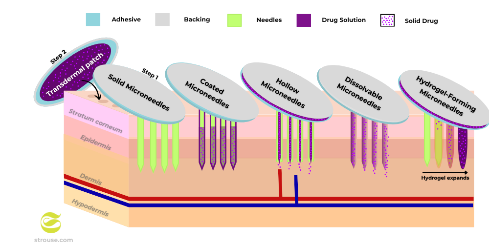 types of microneedle patches