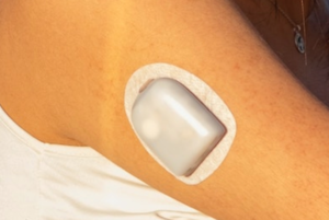 stick to skin cgm die cut